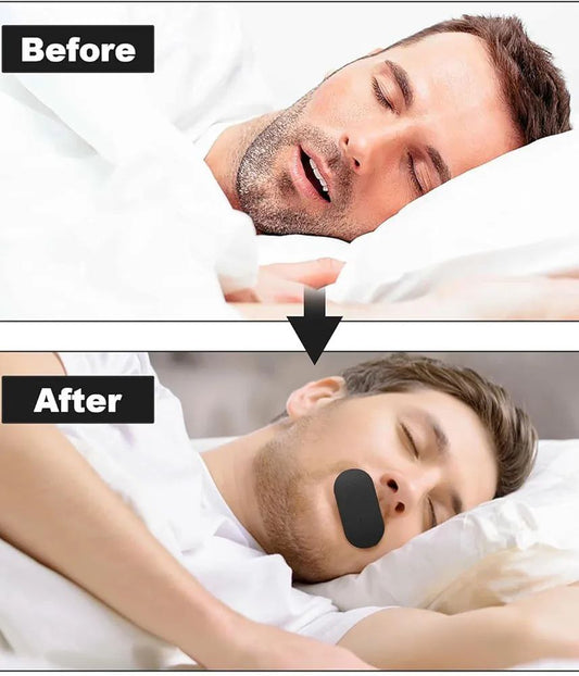 30Pcs Good Night Mouth Tap For Anti Snoring