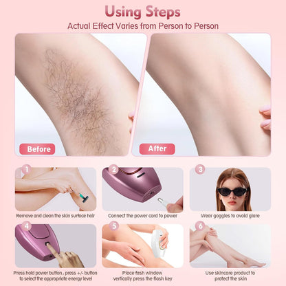 IPL Laser Hair Removal Machine | Painless Permanent Hair Remover Device at Home