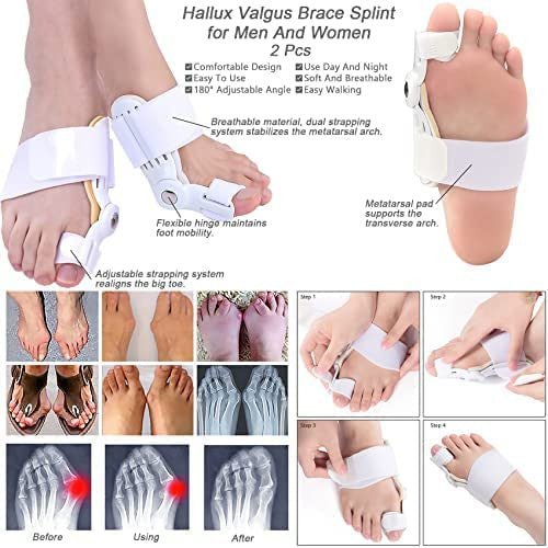 Toe Straightener