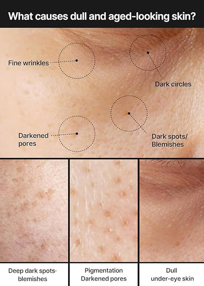 Brightening Cream for Dark Spots & Even Skin Tone | Niacinamide + Tranexamic Acid Face Cream